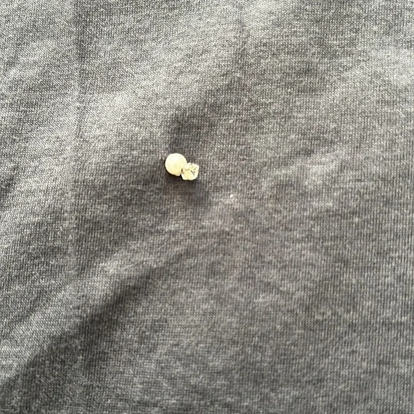 3.1 Phillip Lim Blue Beaded Shift Dress XS/0 - Picture 7 of 7